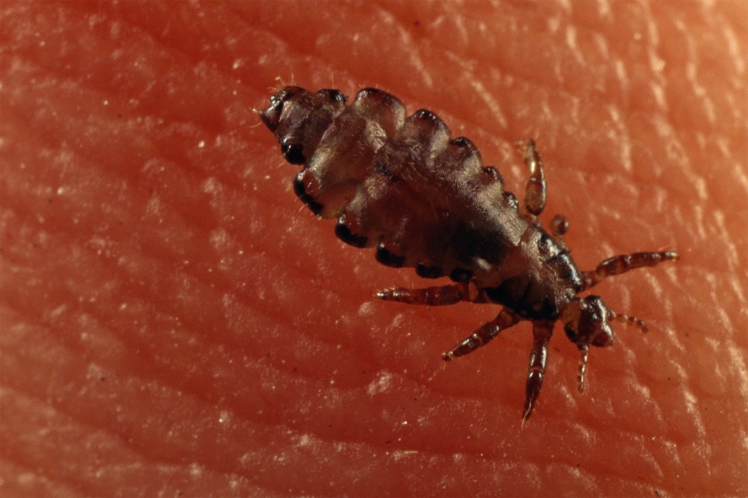 34 interesting facts about louse